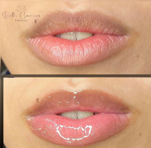 Hydragloss